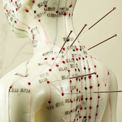 Best Acupuncture Singapore, Acupuncture Clinic Singapore - Baozhongtang